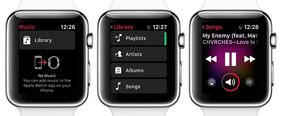 sync amazon music to apple watch